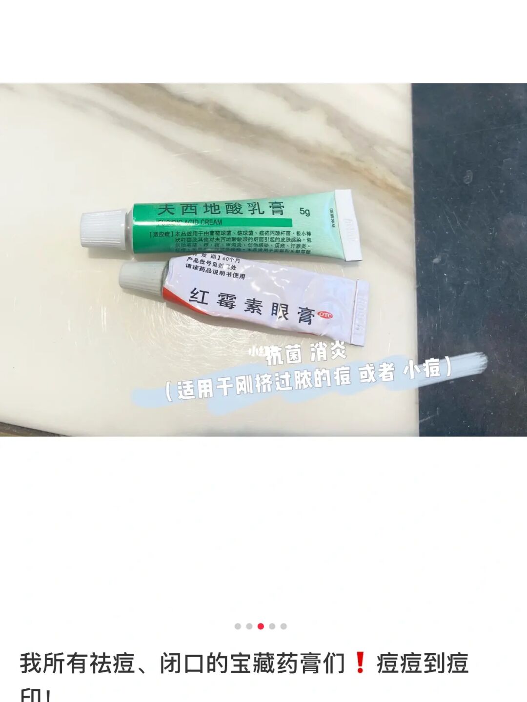 祛痘坑 用点阵好还是激光好_用祛痘药皮肤过敏治疗小妙招_用什么药祛痘效果好偏方