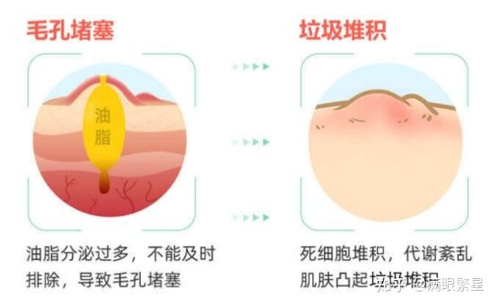 美白收缩毛孔的中药配方_中药美白配方_中药面膜粉配方收毛孔