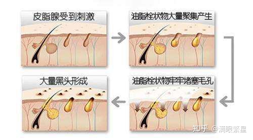 中药面膜粉配方收毛孔_美白收缩毛孔的中药配方_中药美白配方