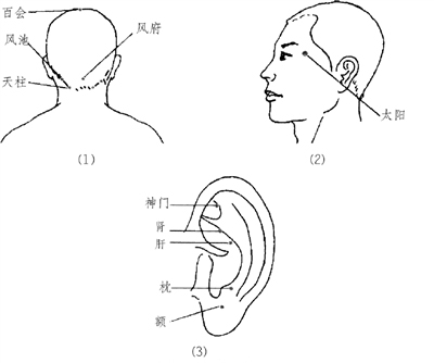 头痛治头，足痛治足_治偏头痛的偏方_产后头痛偏方