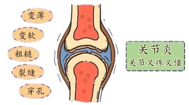 舌根淋巴滤泡增生偏方_子宫内膜增生中医偏方_骨质增生偏方