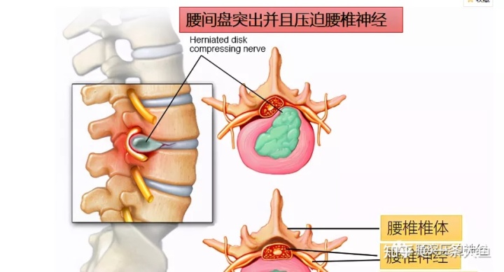 咽炎滤泡增生偏方大全_民间偏方骨质增生_偏方治愈子宫内膜增生