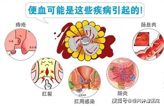 民间治前列腺炎偏方_民间治白血病偏方_民间偏方治便秘