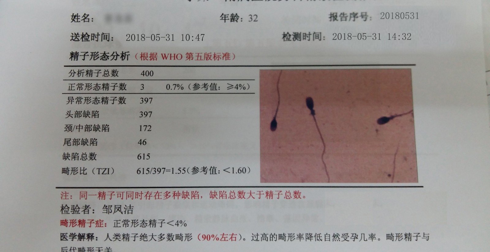 提高精子活力中药配方_精子不液化中药治疗配方_怎么治疗精子不液化