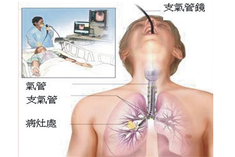 咳嗽性哮喘的偏方_鼻子过敏眼睛痒偏方_过敏性咳嗽偏方