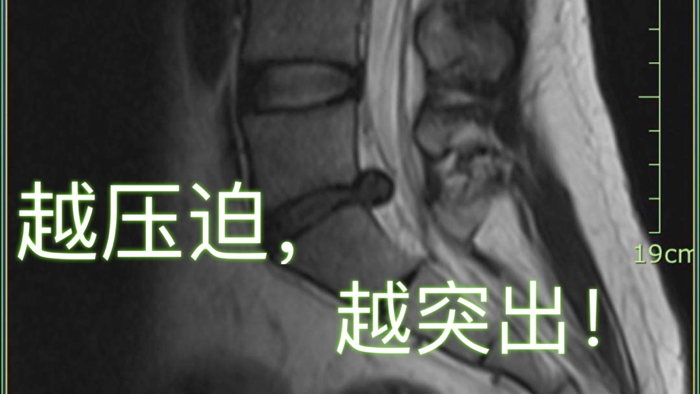 腰椎间盘特效断根秘方_哮喘断根秘方_千家妙方治荨麻疹断根秘方