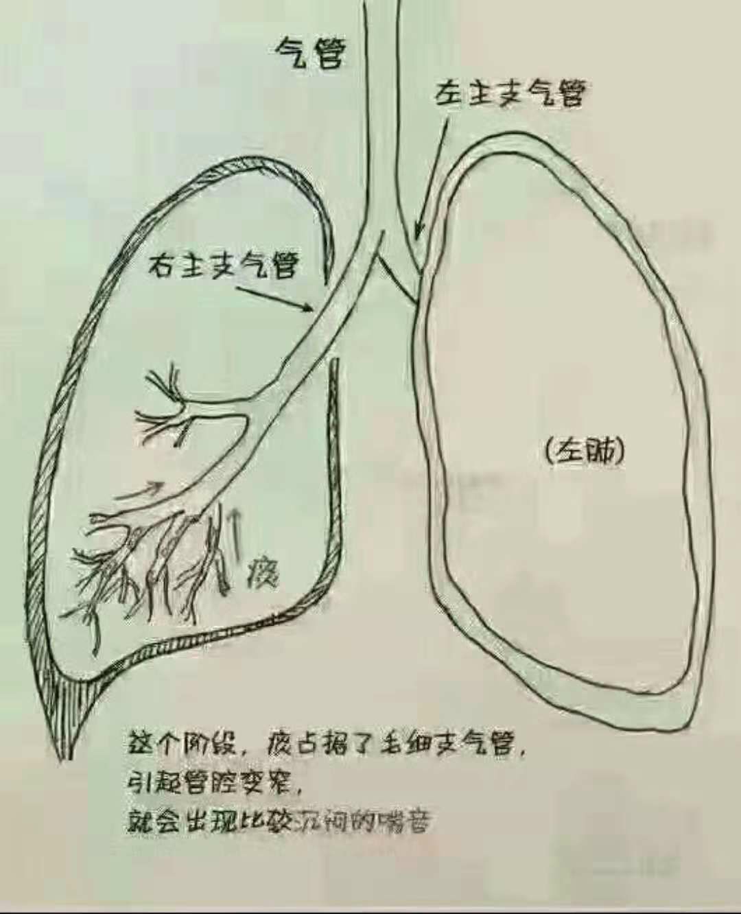 治疗宝宝咳嗽偏方_过敏性咳嗽治疗偏方_治疗咳嗽的小偏方