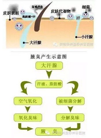 治疗狐臭的偏方_治疗狐臭偏方集_如何治疗狐臭 民间怎么治疗狐臭