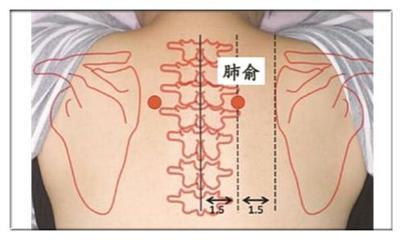 咳嗽单方治最有效_夫妻单方立遗嘱有效吗_单方鉴定有效吗