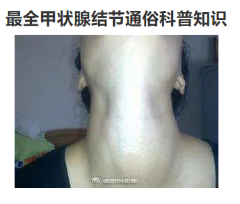 什么中药治甲状腺结节