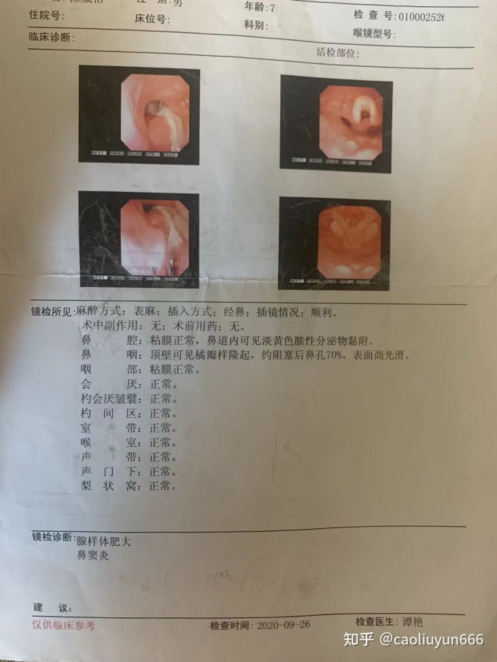 偏方治咳嗽最有效_简单有效治不孕偏方_古老治狐臭有效偏方