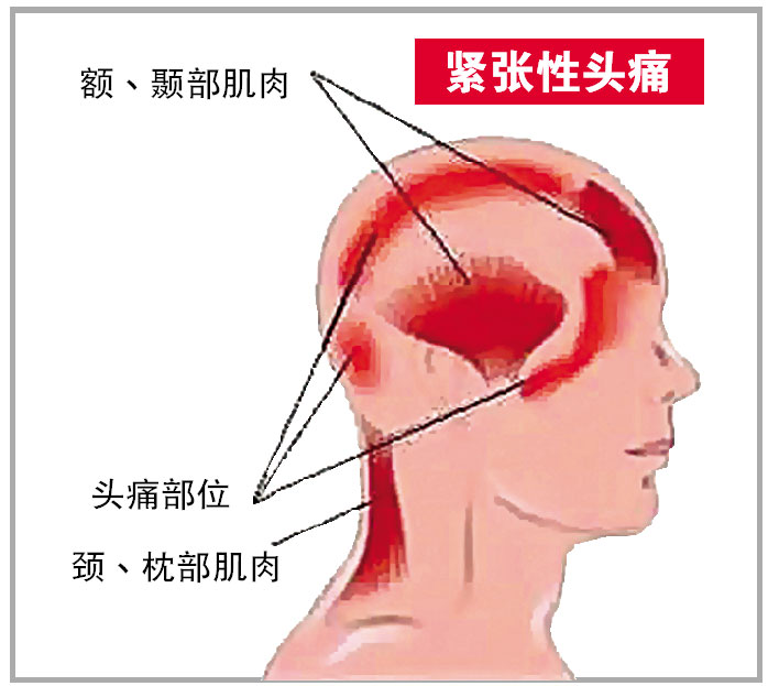 治胃偏方喝小苏打粉_治头痛的小偏方_治癜风偏方治好的案例