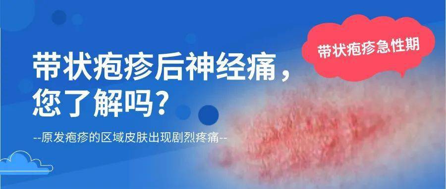 治疗疱疹后神经痛有无偏方_带状疱疹的治疗偏方_带状性疱疹 偏方