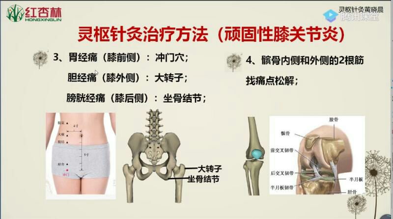 滑膜炎偏方_膝关节滑膜炎的偏方_滑膜炎的偏方治疗方法