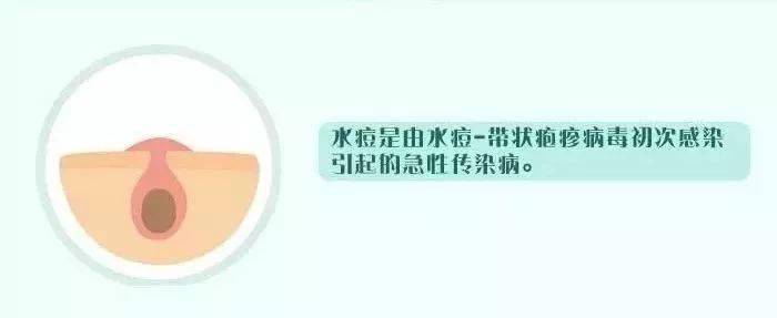 出水痘传染吗_小孩起水痘传染吗_水痘的传染期