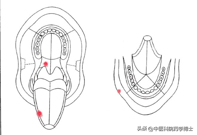 升阳散火汤治疗口腔溃疡_升阳散火汤口疮_一味药根治手脚麻木