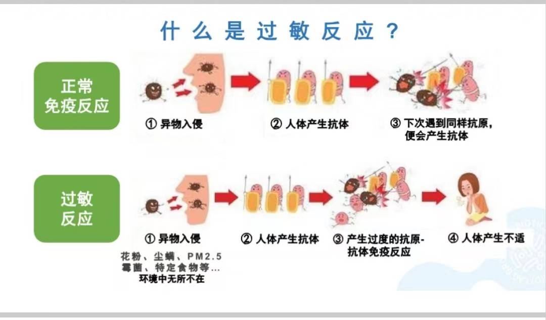 过敏体质过敏_食物过敏是过敏体质_过敏