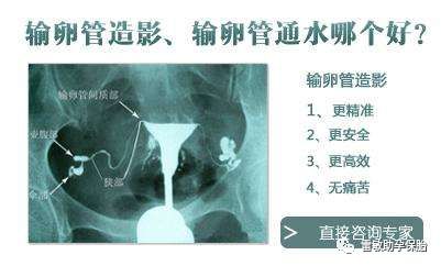 造影后多久可以同房_做完造影21天可以同房吗_三天前同房可以造影吗