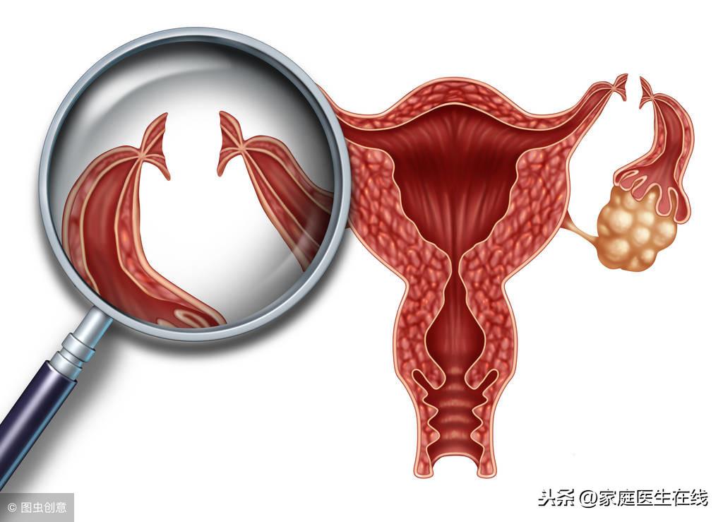 老年阴炎中医治疗偏方_治疗阴道炎的偏方_老偏方治疗灰指甲偏方