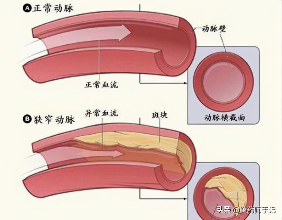 中药去湿气减肥最佳配方子_脾肾阳虚湿气重的中药方子_治疗肾阳虚的经典方子