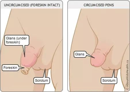 包皮淋巴管炎可以手术切除吗_杭州下沙可以做包皮手术吗_包皮手术后多久可以同房
