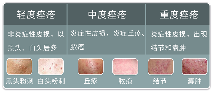 治疗狐臭的最佳方法_暗疮的最佳治疗方法_治疗臭脚气的最佳方法