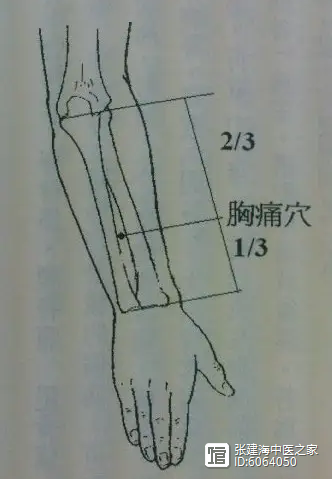 _靶向探针的劣势_靶向探针