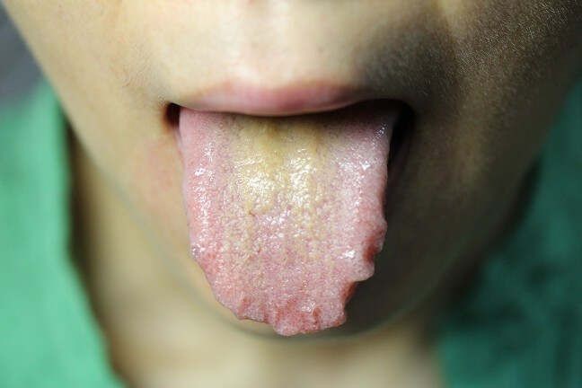 【李玉宾老师讲舌诊二】之舌诊的中土脾胃【下】 - 缘水禅心 -