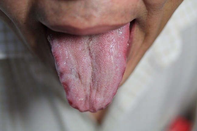 【李玉宾老师讲舌诊二】之舌诊的中土脾胃【下】 - 缘水禅心 -