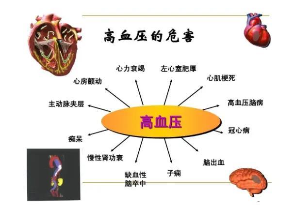 一分钟降血压妙招小偏方_怎样降血压小偏方_偏方降血压最好的方法